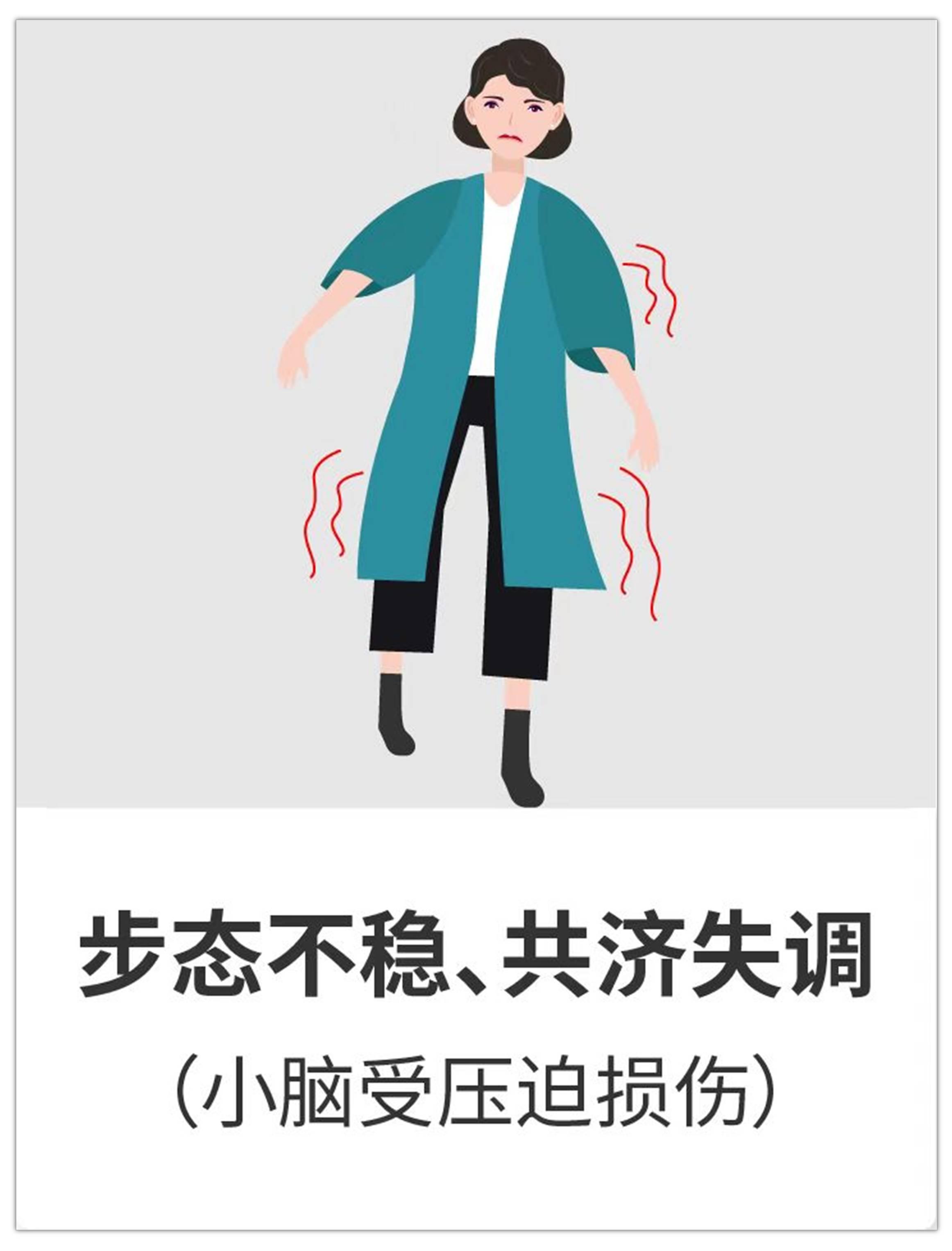 聽神經(jīng)瘤進(jìn)展會(huì)出現(xiàn)哪9大癥狀？治療后都能恢復(fù)嗎？手術(shù)關(guān)鍵是什么？