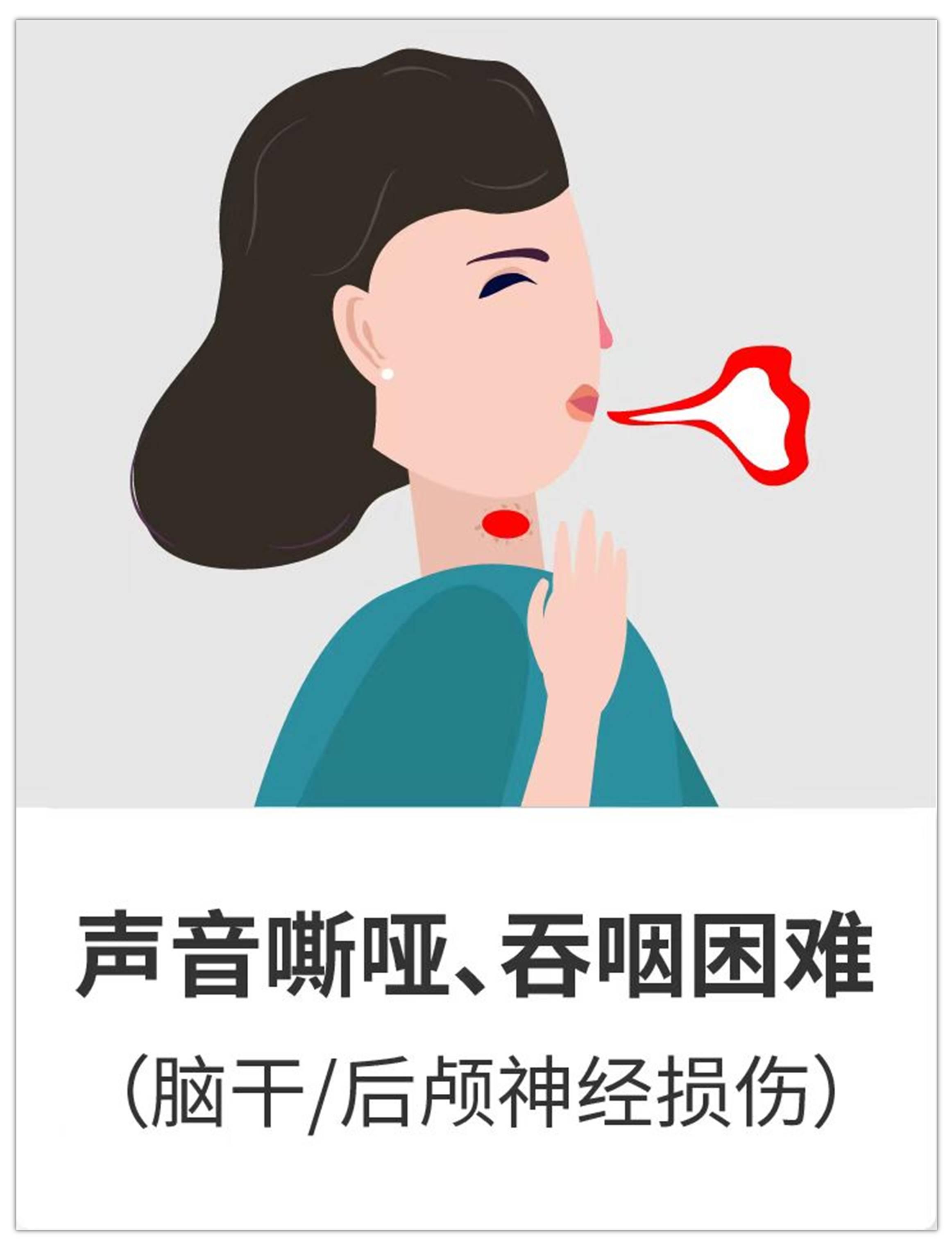 聽神經(jīng)瘤進(jìn)展會(huì)出現(xiàn)哪9大癥狀？治療后都能恢復(fù)嗎？手術(shù)關(guān)鍵是什么？