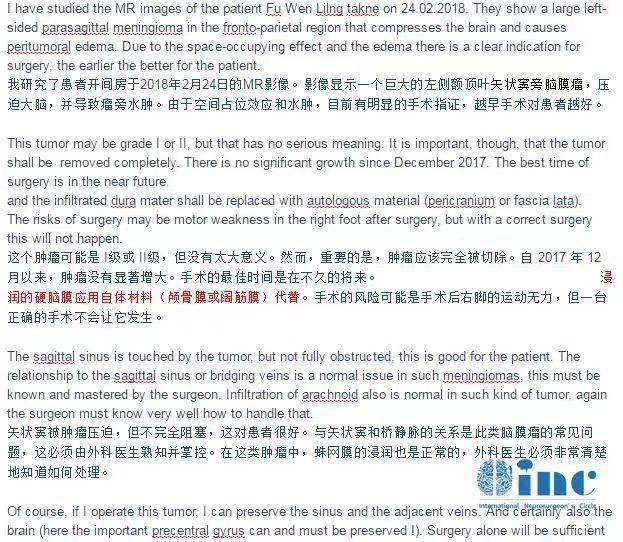 較大腦膜瘤長在大靜脈竇、大腦鐮旁能治愈嗎，復雜腦膜瘤的治療策略