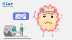 橋小腦角區(qū)腦膜瘤手術(shù)風(fēng)險(xiǎn)大嗎