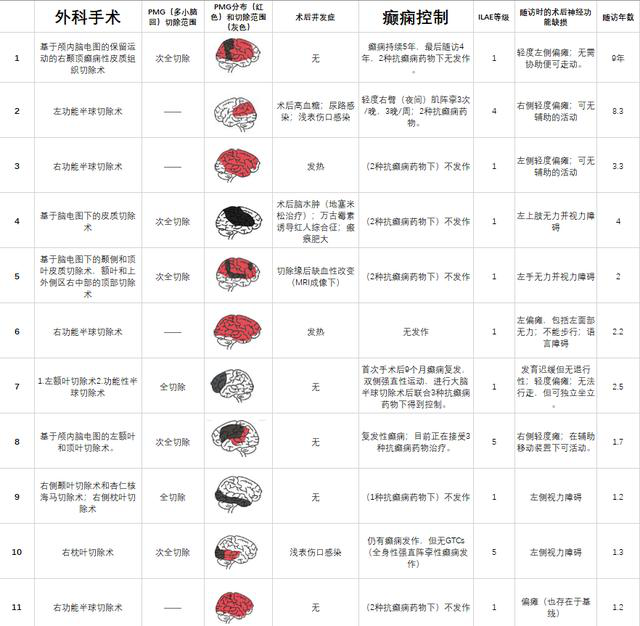 癲癇