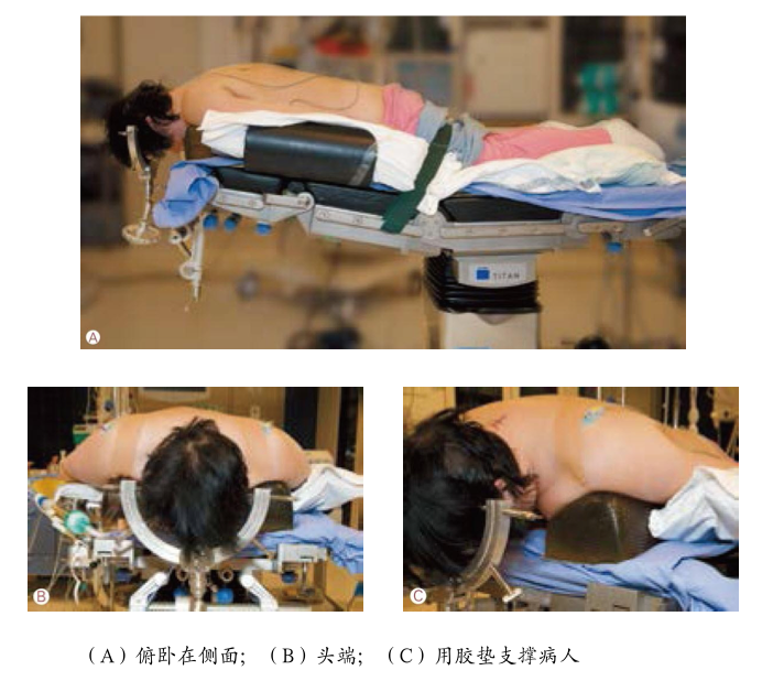 脊柱腫瘤常見有哪些病變，影像特點(diǎn)及手術(shù)分析