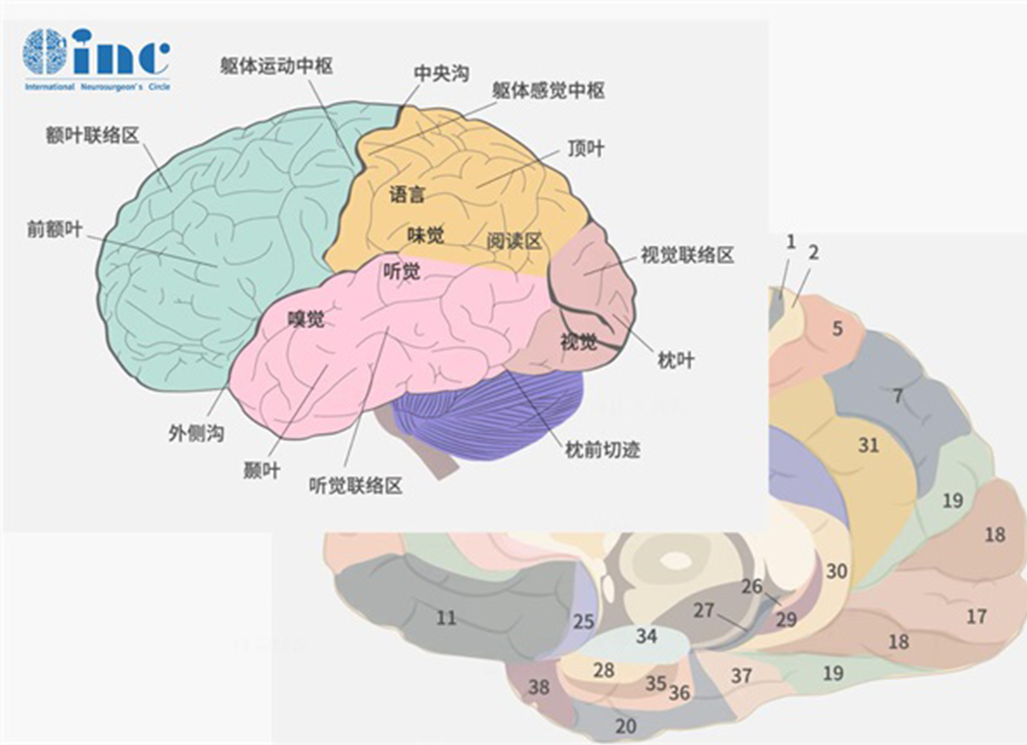 什么是功能區(qū)腦膠質(zhì)瘤？解讀功能區(qū)定位較新觀點及手術(shù)策略