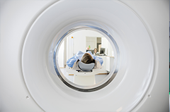 放射性腦損傷的 ＭＲＩ 研究進(jìn)展