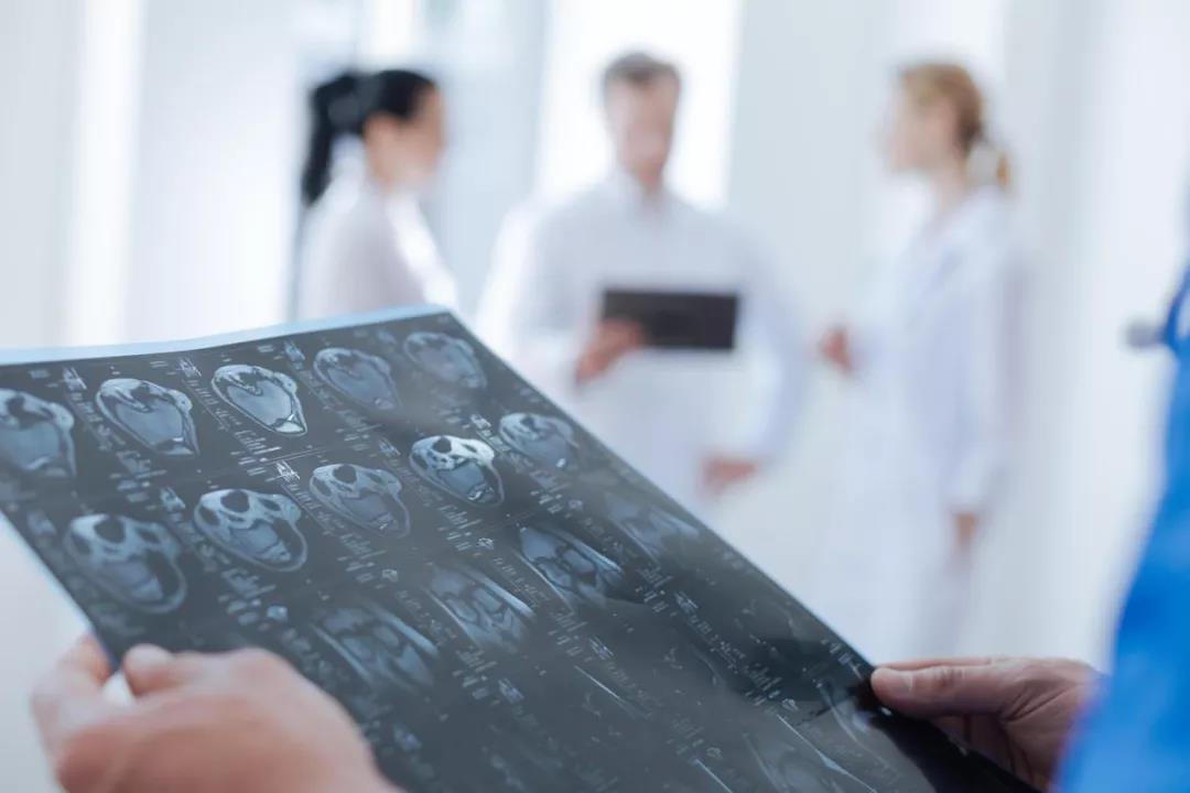 6大“早期信號”提示兒童腦腫瘤