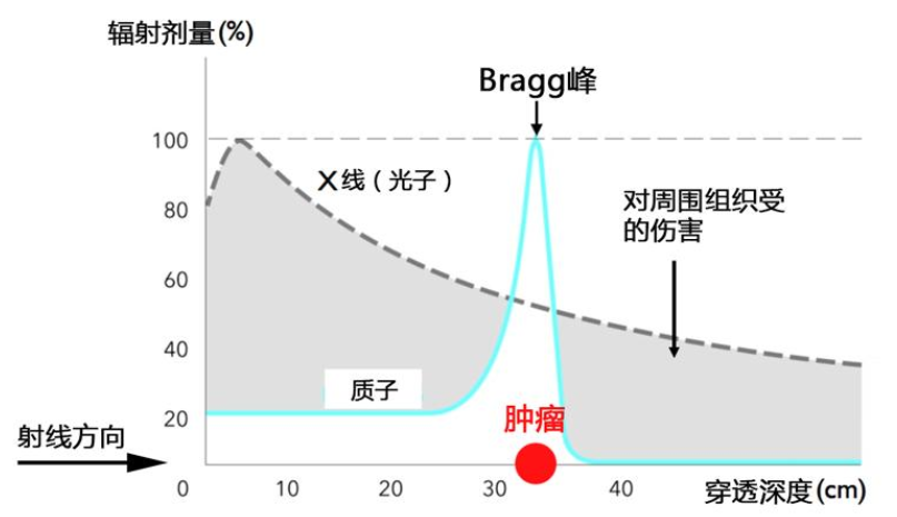 質(zhì)子治療腦腫瘤