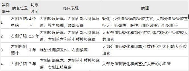 <a href='/naoxueguanliu/' target='_blank'><u>腦海綿狀血管瘤</u></a>患者放療