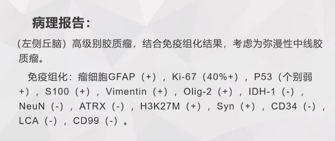 較大丘腦膠質(zhì)瘤治療