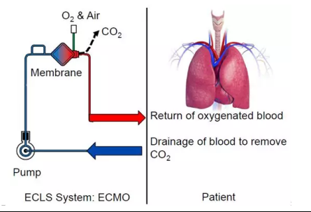 一線生機(jī)、不放棄，心跳驟停后ECMO“硬核”技術(shù)屢創(chuàng)奇跡