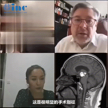 腦干海綿狀血管瘤