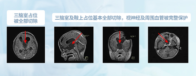德國<a href='/guojizhuanjia/Bertalanffy.html' target='_blank'><u>巴特朗菲</u></a>教授