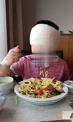腦干海綿狀血管瘤手術(shù)
