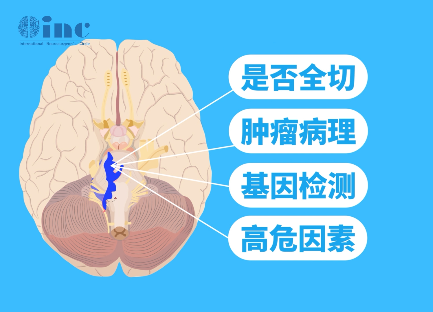 腦室外神經(jīng)細(xì)胞瘤是什么??？