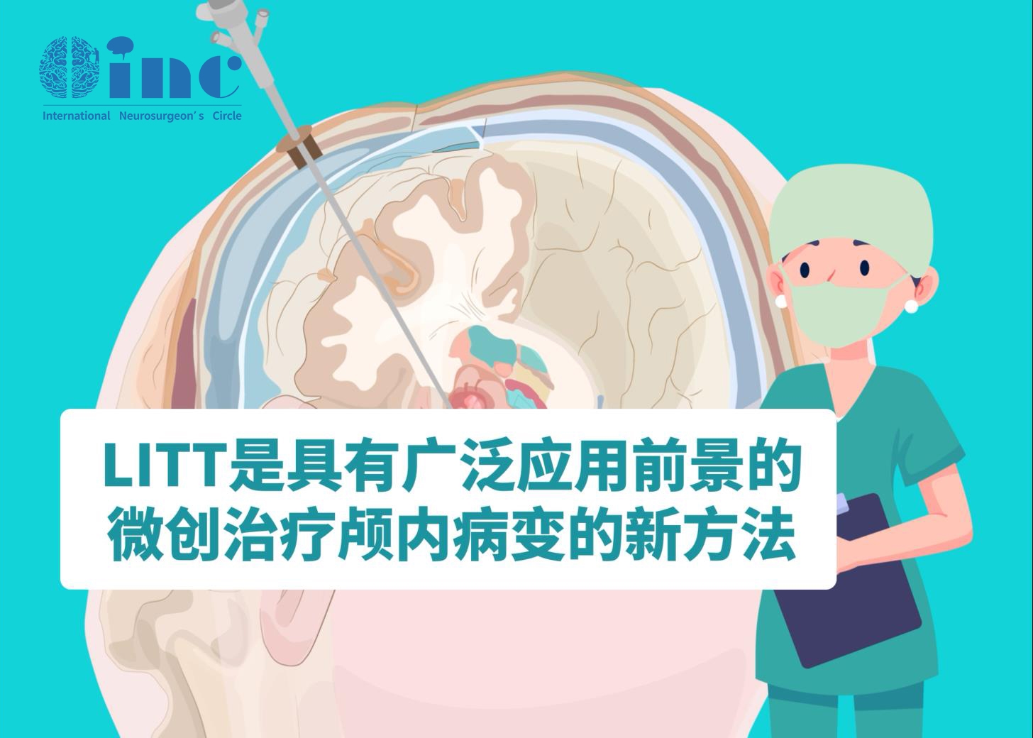 LITT技術(shù)