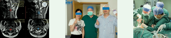 INC成功手術(shù)案例之脊髓髓內(nèi)腫瘤可能癱瘓的他，全切術(shù)后沒有復(fù)發(fā)、行走自如！