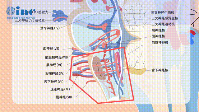 延髓腫瘤