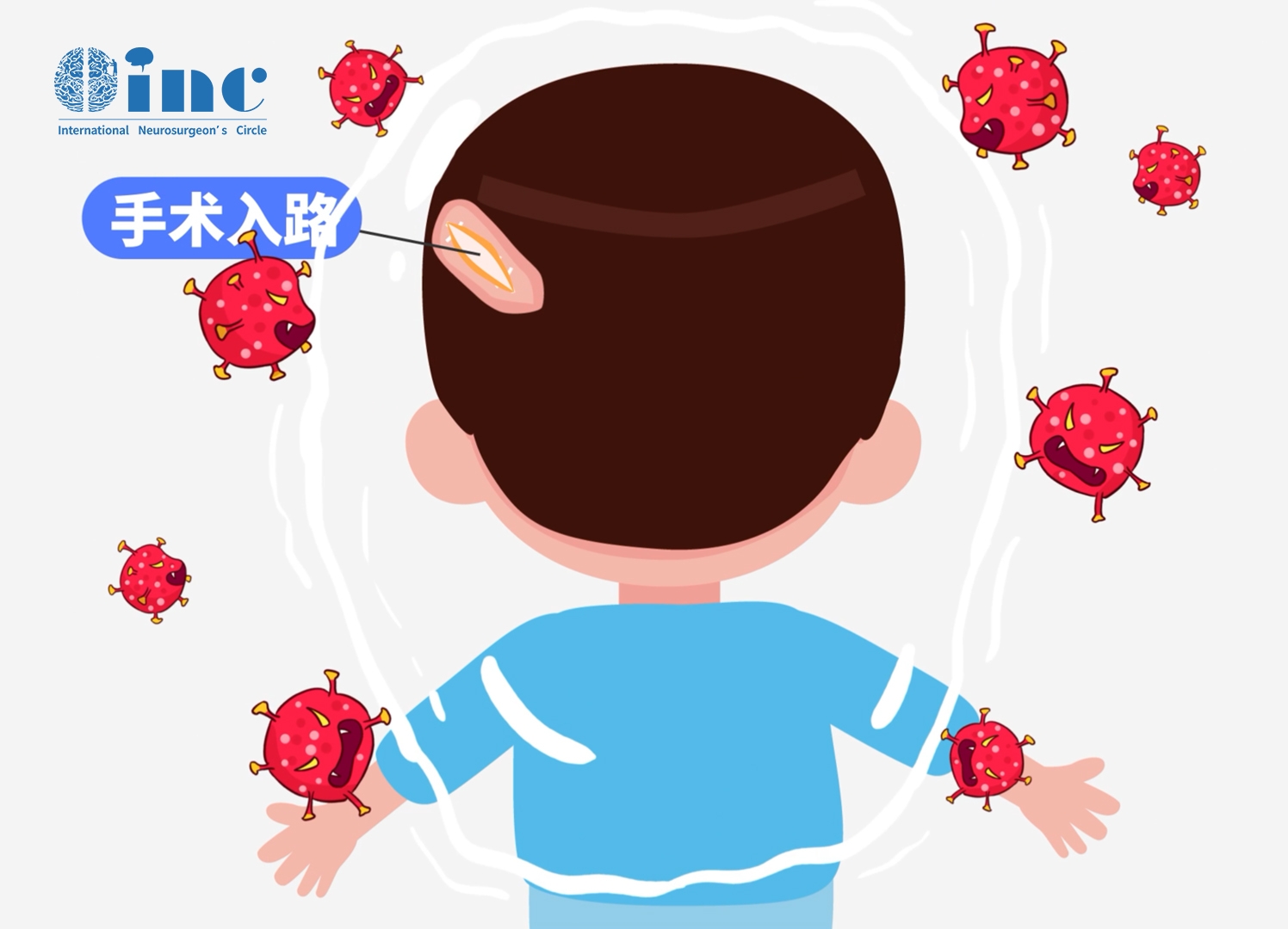 嬰幼兒<a href='/naoliu/' target='_blank'><u>腦瘤</u></a>