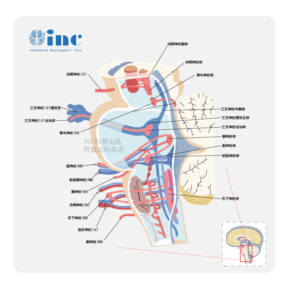 中腦頂蓋<a href='/jiaozhiliu/' target='_blank'><u>膠質(zhì)瘤</u></a>