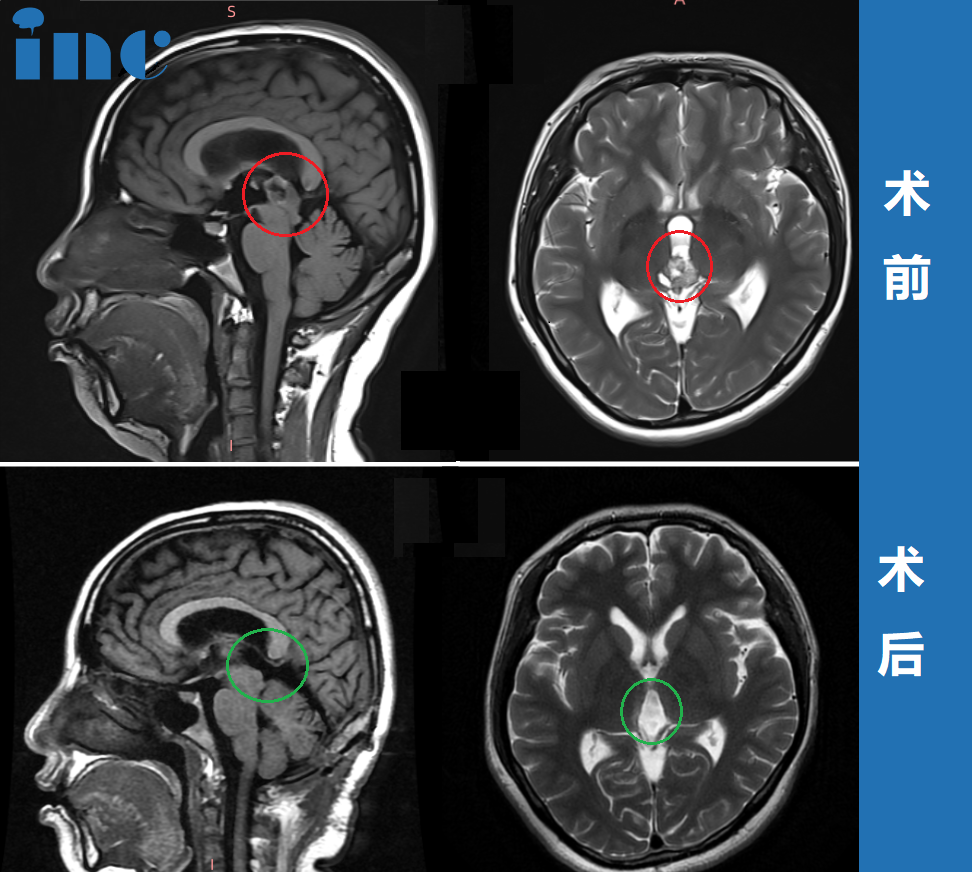 北京天壇醫(yī)院外籍專家巴特朗菲教授