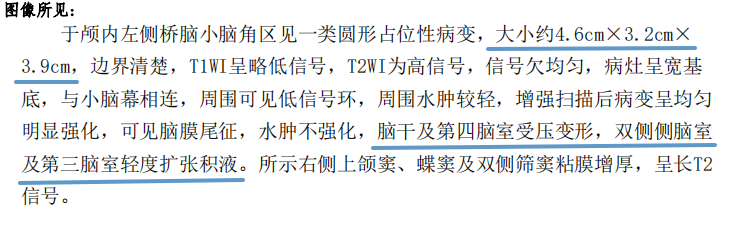 北京天壇醫(yī)院,巴特朗菲,神經(jīng)外科,INC