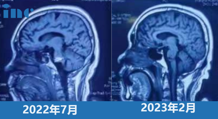 巴特朗菲,INC