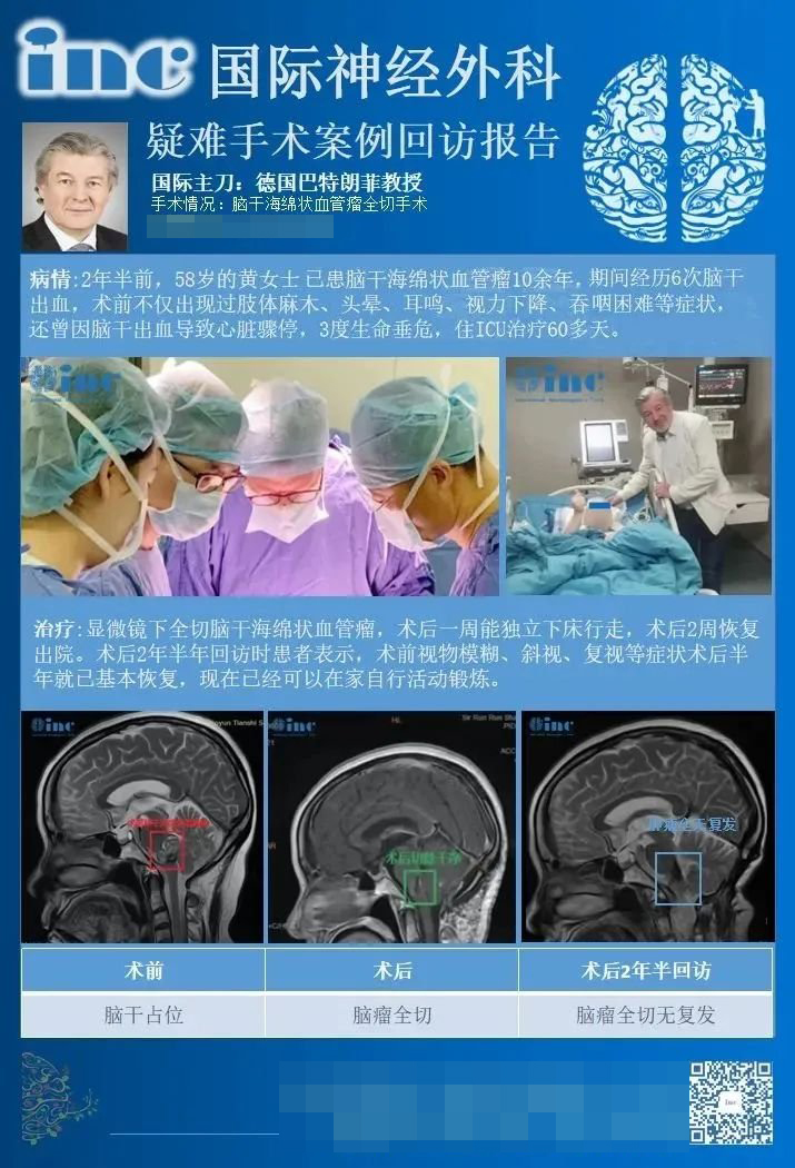 腦干海綿狀血管瘤,巴特朗菲教授