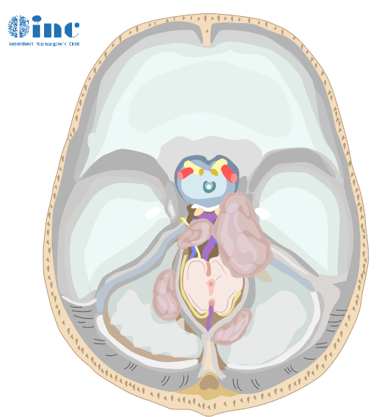 筷子技術(shù),福洛里希,Froelich,INC
