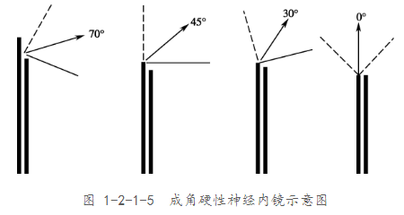 單鼻孔神經(jīng)內(nèi)鏡手術(shù)