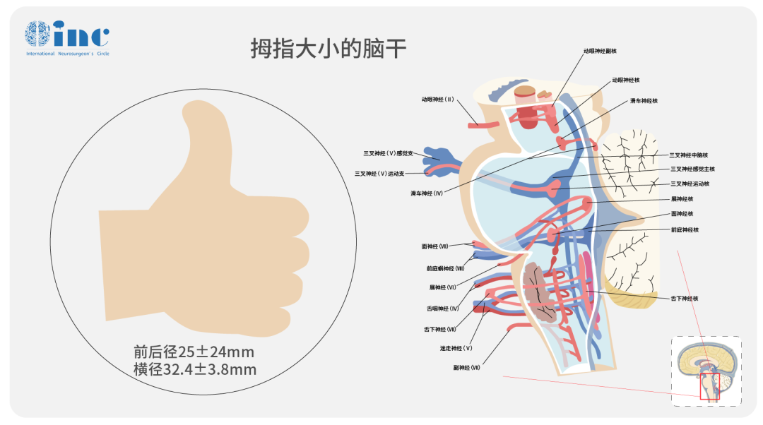 腦干海綿狀血管瘤手術(shù)