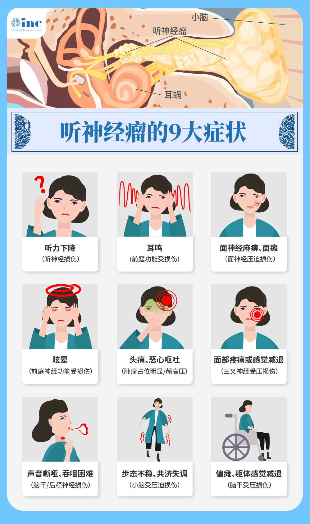突發(fā)耳聾耳鳴也要警惕聽神經(jīng)瘤