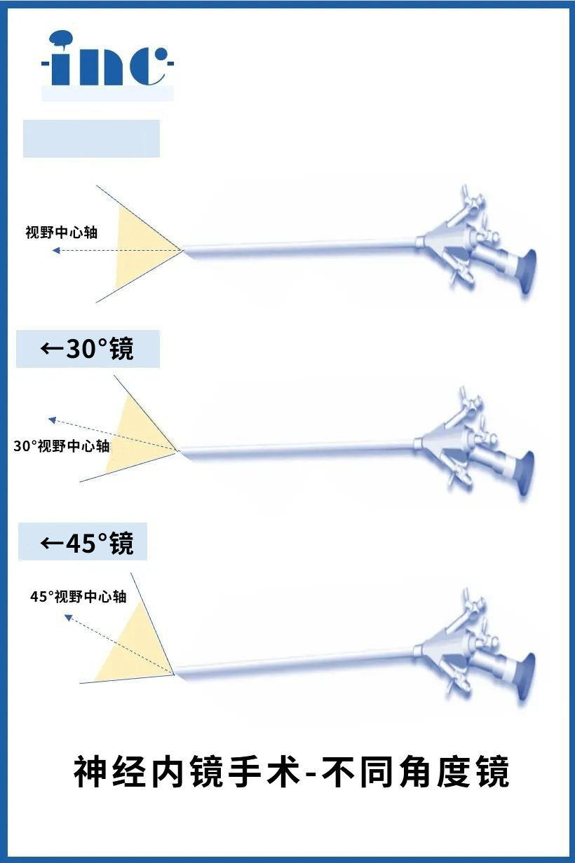 擁有不同角度的硬鏡