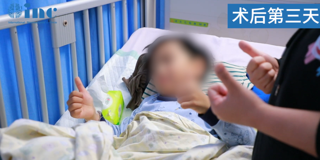 兒童腦腫瘤案例