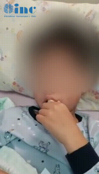 兒童腦腫瘤案例