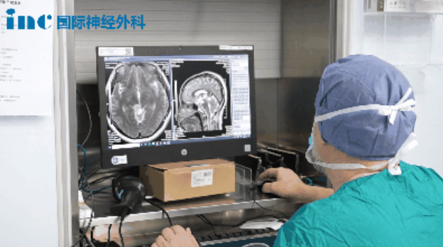 查看影像、調(diào)節(jié)顯微鏡……巴教授細(xì)致做術(shù)前準(zhǔn)備