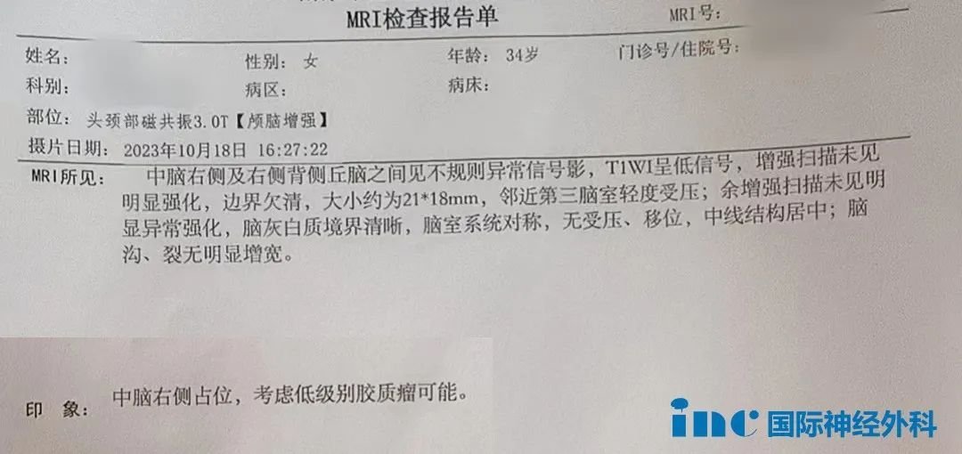 低級別膠質(zhì)瘤