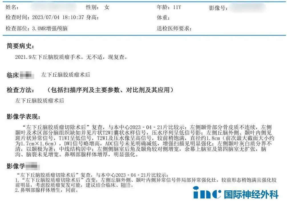 11歲女孩Judy-左側(cè)丘腦和顳葉內(nèi)側(cè)膠質(zhì)瘤術(shù)后復(fù)發(fā)