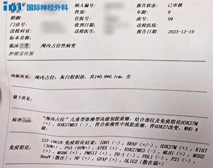 9歲女孩腦干彌漫高級(jí)別橋腦膠質(zhì)瘤