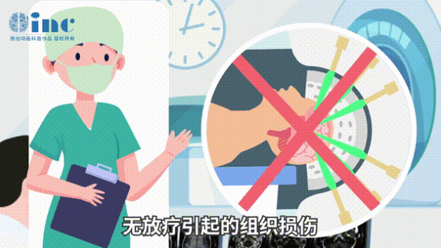 順利性高