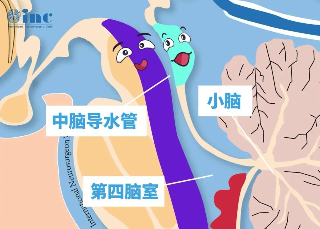 中腦頂蓋位置示意圖，藍(lán)色部分為頂蓋