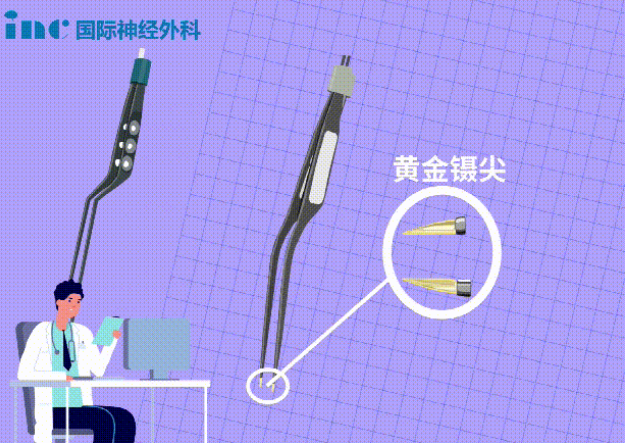 雙較電凝是黃金鑷尖？