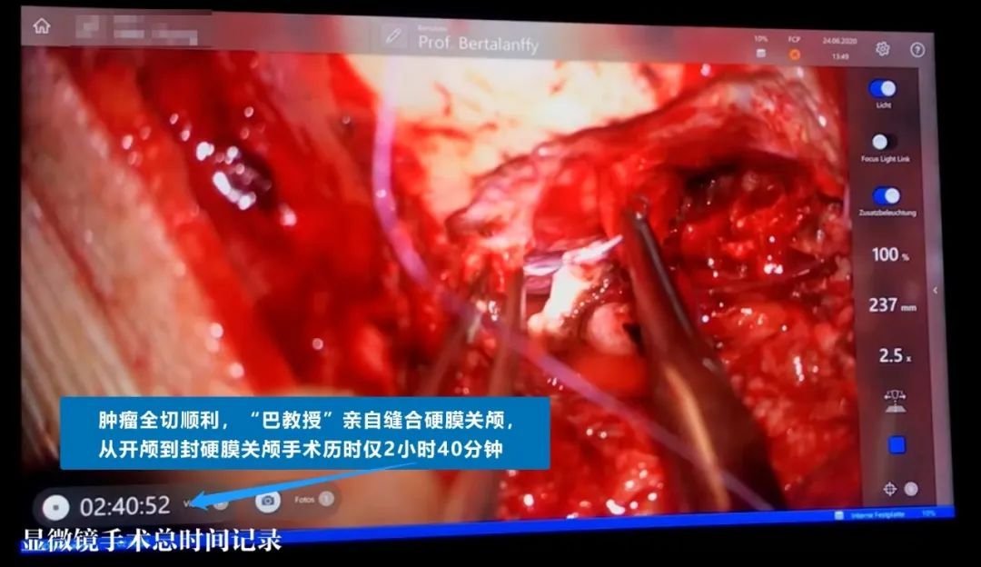 INC德國(guó)巴特朗菲教授手術(shù)實(shí)拍