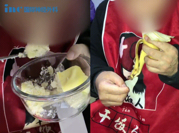福洛里希教授較大脊索瘤案例
