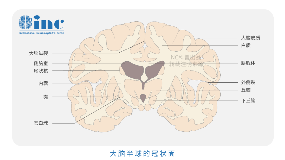 功能區(qū)海綿狀血管瘤案例