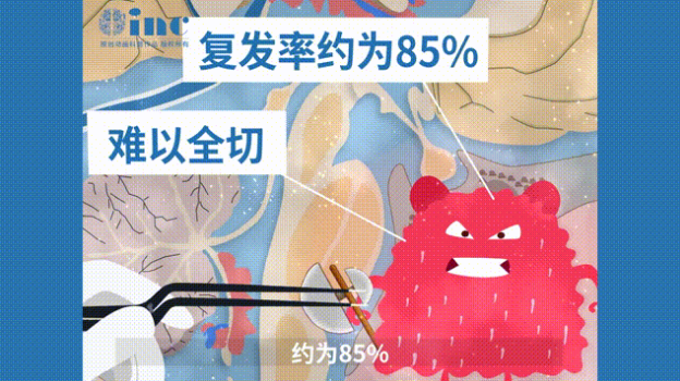 全切較大脊索瘤