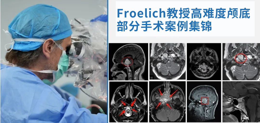 INC法國(guó)福洛里希教授  　　部分精彩案例交流