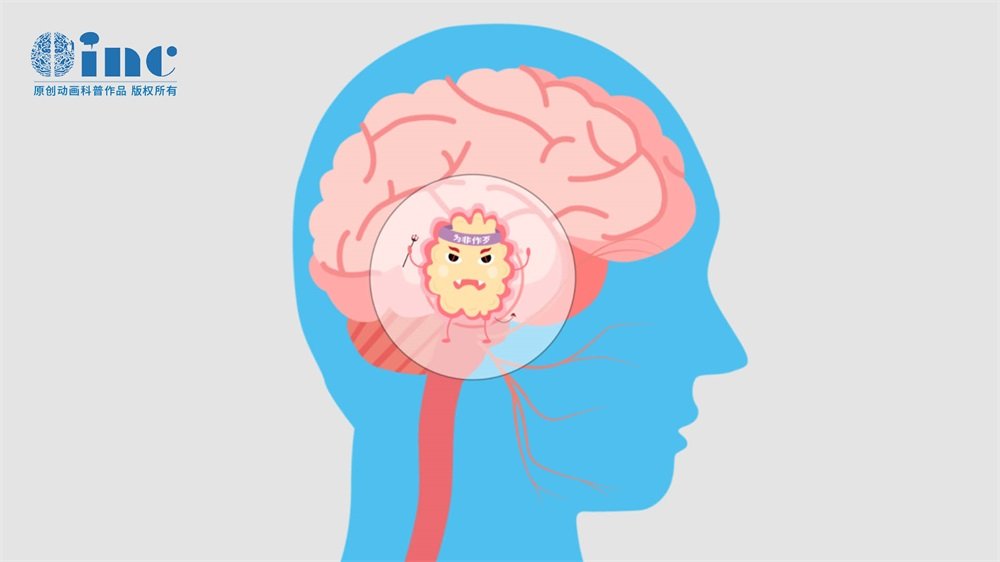 室管膜瘤who1級是什么意思？