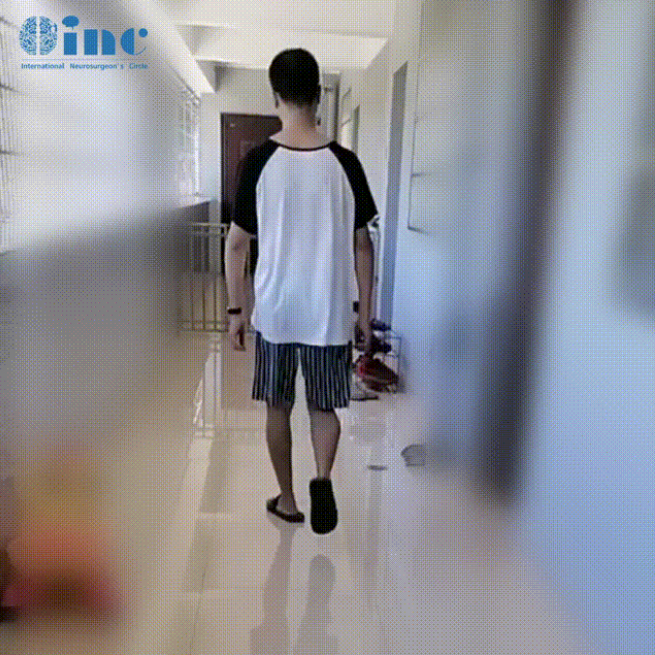 34歲男性-腦干延髓-頸髓室管膜瘤WHO2級案例術(shù)后圖片
