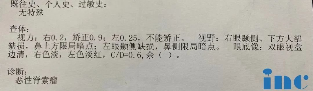 開顱手術(shù)