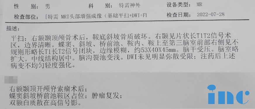 經(jīng)鼻內(nèi)鏡手術(shù)