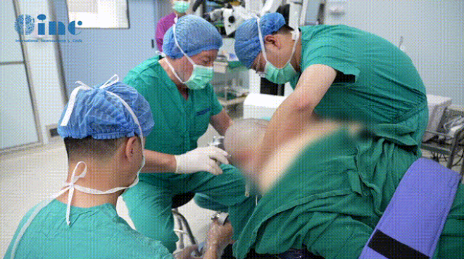 手術開始前，巴教授親自安裝頭架并為患者固定上頭架